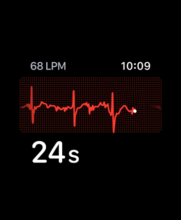 App ECG, latidos por minuto en la esquina superior izquierda, línea de ritmo cardiaco, temporizador