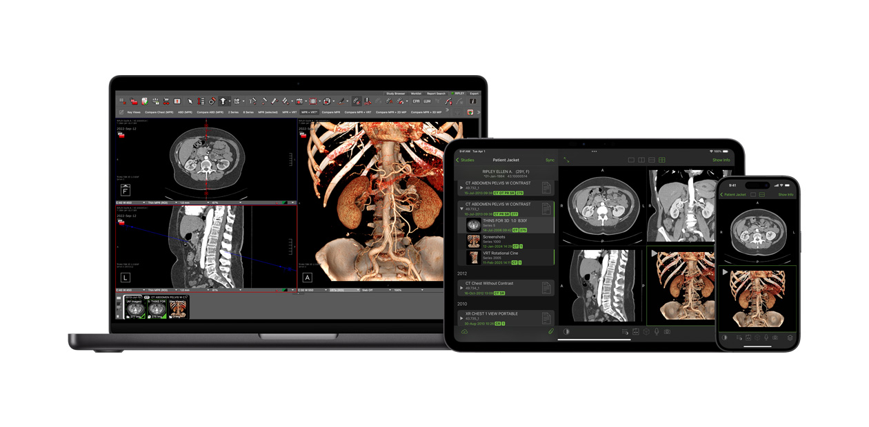 Software, die die Visage App anzeigt, mit der Radiolog:innen große Diagnosedateien interpretieren.